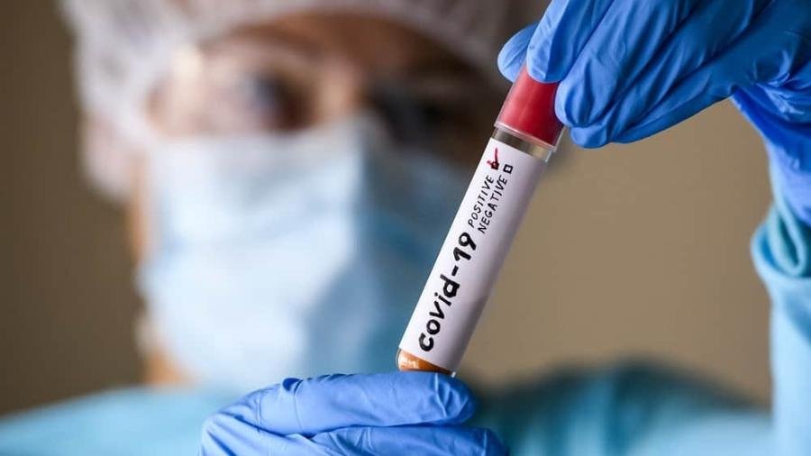 Se mantiver ritmo, Brasil pode chegar a 1 milhão de casos de Covid-19 nesta semana