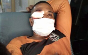 Obstinação pela cegueira: a violência policial contra a manifestação em Recife no dia 29 de maio As balas tinham mira certeira: cegar os que enxergam o óbvio e lhes tirar a força da lucidez que os mobiliza.