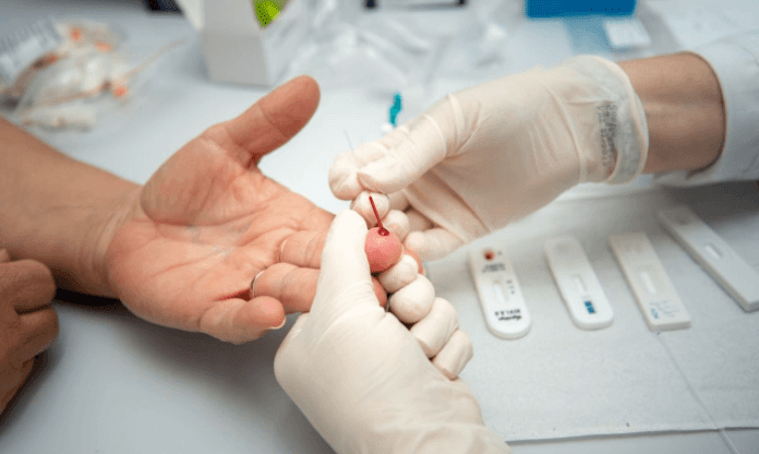 Teste rápido de HIV 2