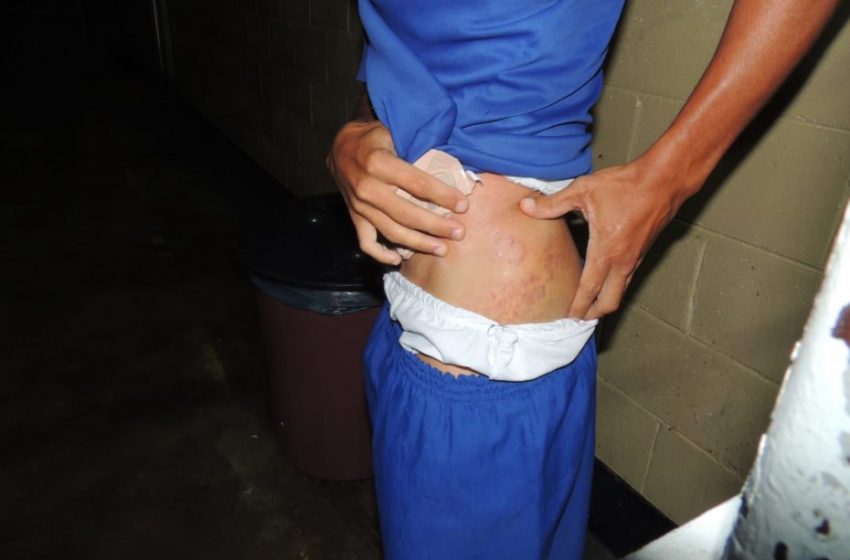  OAB Alagoas recebe duas novas denúncias de tortura no sistema prisional