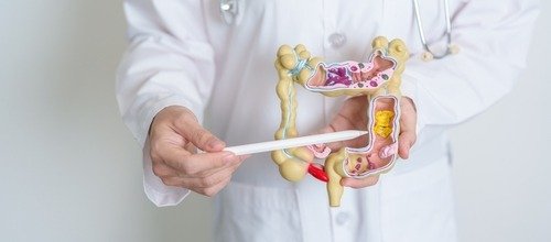 Exame de sangue nas fezes é opção acessível para rastrear câncer colorretal