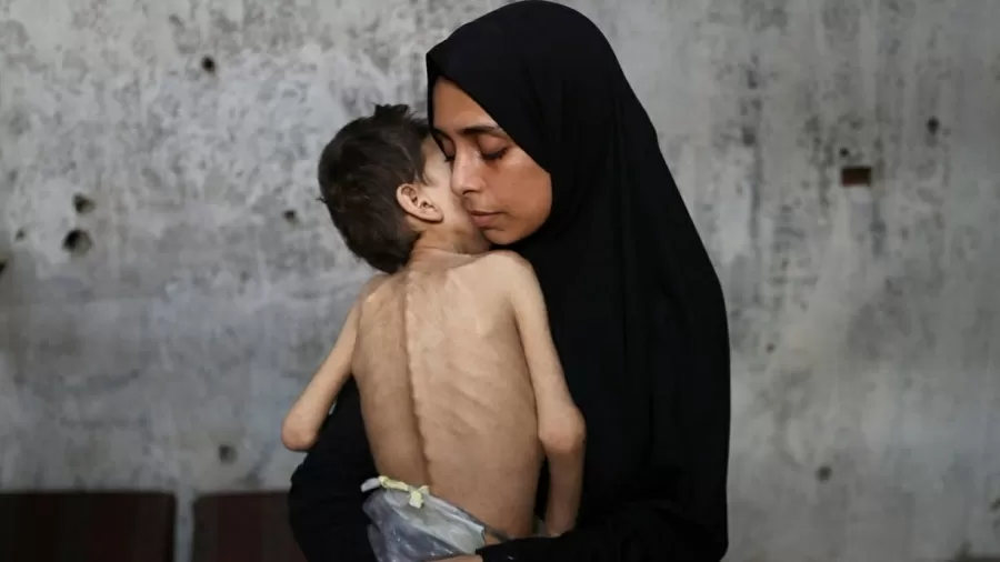 Fome em Gaza atinge níveis críticos e é comparada à grande fome da Etiópia nos anos 1980