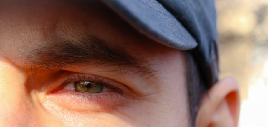 “Trend” nas redes sociais, raspar os cílios pode causar lesões nos olhos
