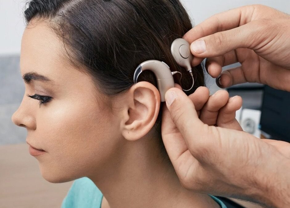 Implante coclear: quem pode fazer a cirurgia que devolve a audição