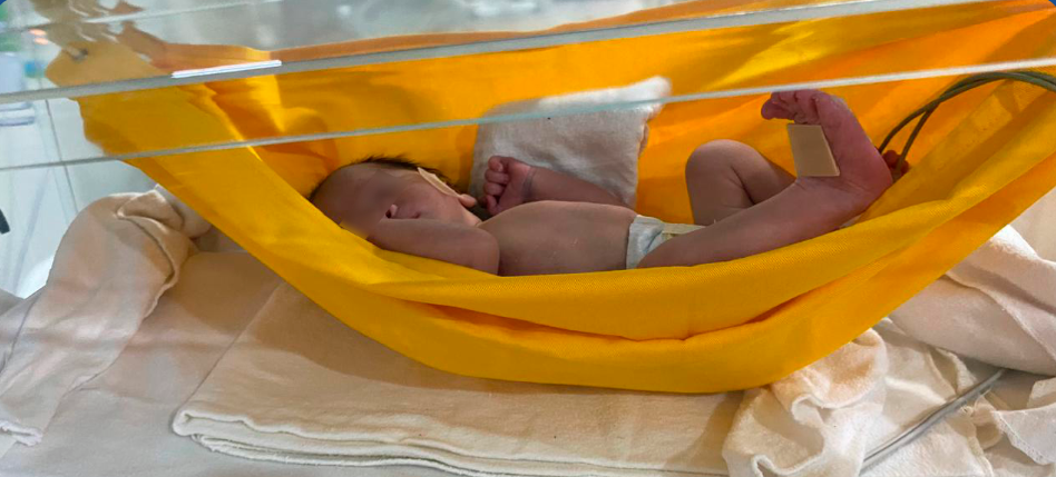 Dormir em rede ajuda prematuros a ganharem peso, indica estudo no CE