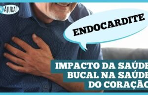 Endocardite: o perigo oculto nos seus dentes