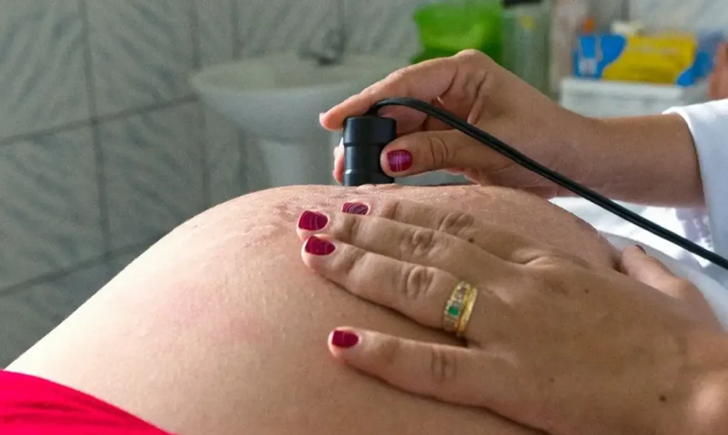 Estudos apontam que Bolsa Família reduz mortalidade materna, infantil e incidência de doenças