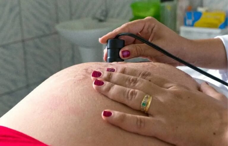 Parto normal é preferência no início da gestação, mas cesarianas seguem maioria no Brasil