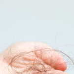 O que o inverno tem a ver com a queda de cabelo? Entenda essa relação