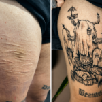 Projeto usa tatuagem para ressignificar cicatrizes e fortalecer autoestima em Alagoas